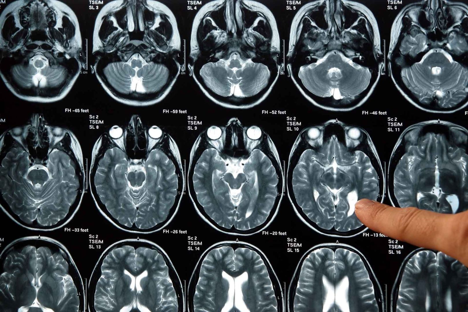 Diplomado en Bases Anatómicas de Imagenología Normal