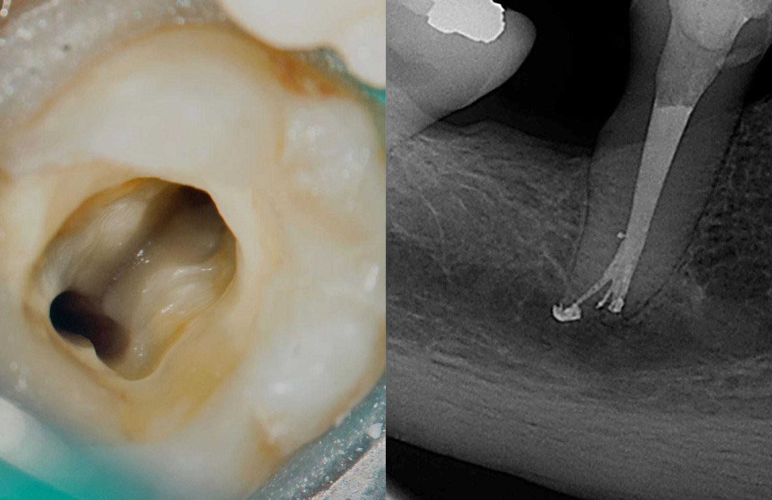 Programa de formación de especialista en endodoncia